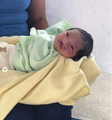 Una madre abandonó a su bebé recién nacido por tener el labio hendido en México