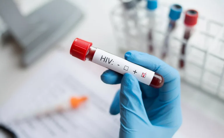 Registran más de 55,000 pacientes con carga viral de VIH durante un año